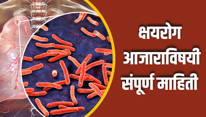 क्षयरोग आजाराविषयी संपूर्ण माहिती TB Disease Information In Marathi 1 TB Disease Information In Marathi